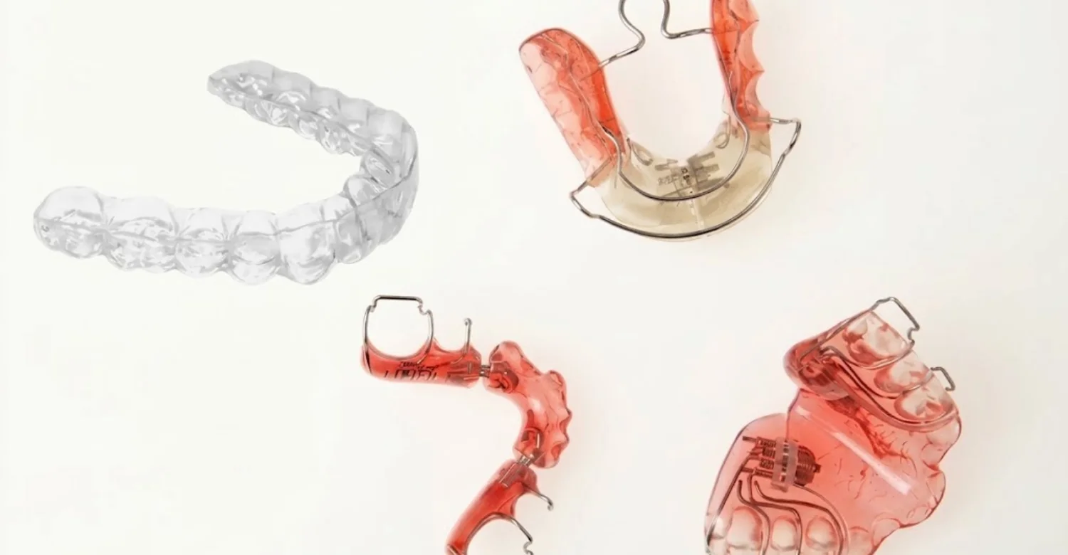 fixed retainers vs removable retainers1